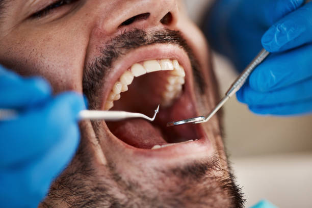 Best Cracked Tooth Emergency Dentist  in Hanover, PA